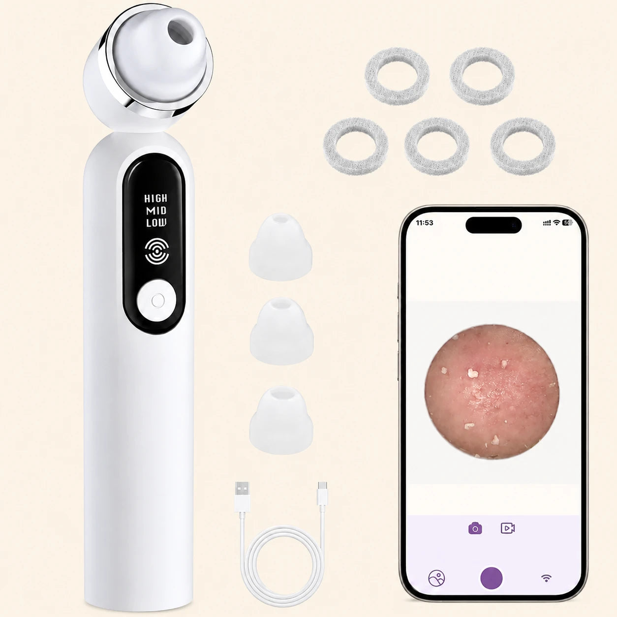 Teaifa™ 2109-Electric Blackhead Remover
